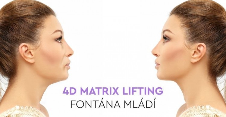4D Matrix lifting = spojení dvou ikonických zákroků v jedno ošetření s garancí zpomalení stárnutí. Stimuluje kolagen a přirozeně vypíná a zpevní pleť. V ceně je ošetření celého obličeje, očního okolí a podbradku. Vhodné pro ženy a muže 40+