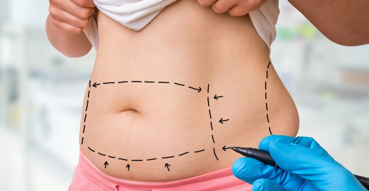 Nová injekční lipolýza od Dermagenetic zaručuje krásné křivky bez operace! Velmi účinná a bezpečná redukce tuků díky štěpení tukových buněk.